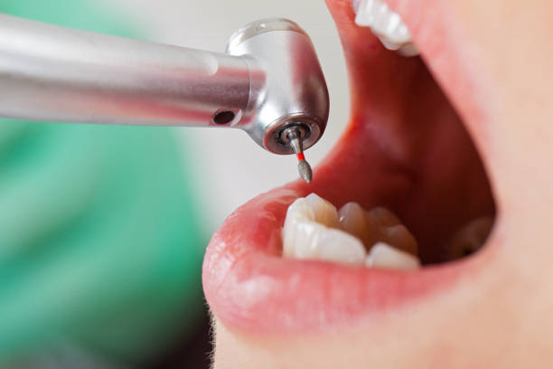 Best Emergency Dental Surgery in K I Sawyer, MI